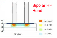 Elight + machine bipolaire d'épilation de rf avec blanchissent la peau de corps